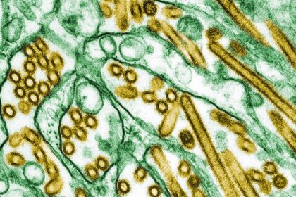 CDC Confirms First US Case of Severe Bird Flu